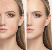 Load image into Gallery viewer, Magic Skin Retouch | 10 Photoshop Actions
